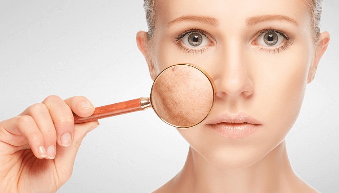 Skin Pigmentation: Cure with Home Remedies